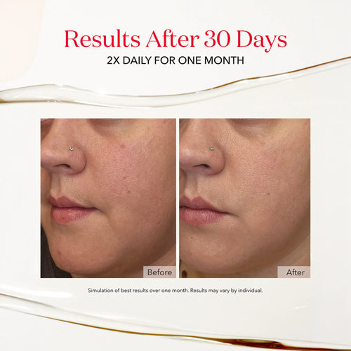 Reduced the appearance of fine lines