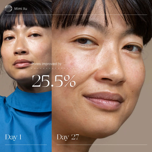 Softens appearance of fine lines and wrinkles